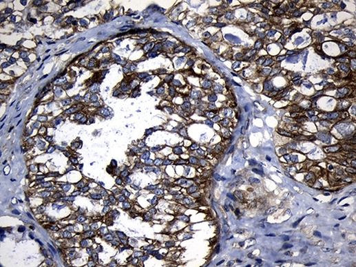 CHP1 Antibody in Immunohistochemistry (Paraffin) (IHC (P))