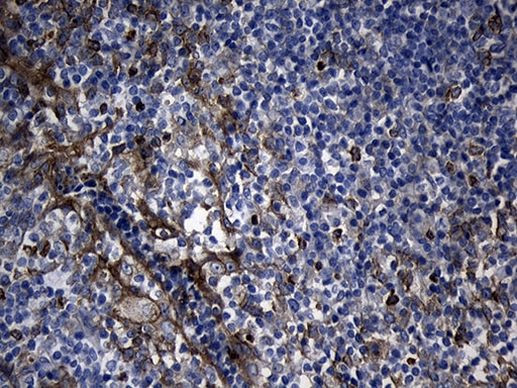 CHP1 Antibody in Immunohistochemistry (Paraffin) (IHC (P))