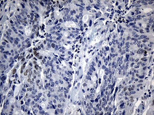 BHLHE40 Antibody in Immunohistochemistry (Paraffin) (IHC (P))