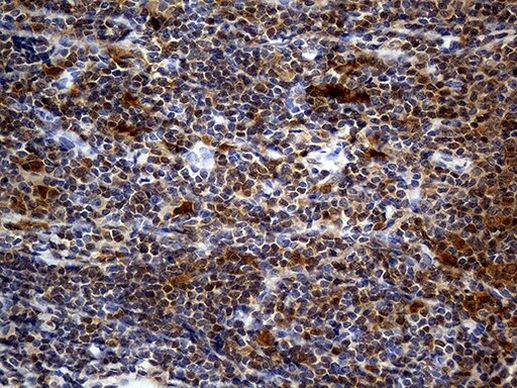 DAPP1 Antibody in Immunohistochemistry (Paraffin) (IHC (P))