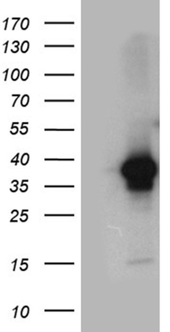 DAPP1 Antibody in Western Blot (WB)