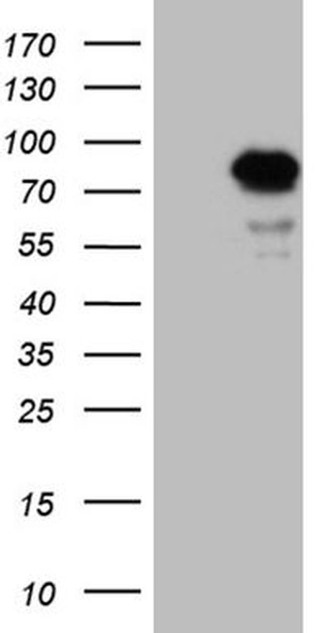 LZTS1 Antibody in Western Blot (WB)