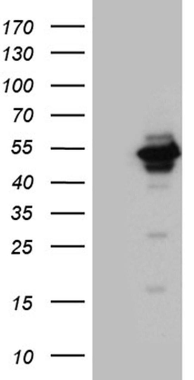 UBAC1 Antibody in Western Blot (WB)