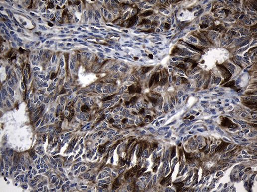 RRM2 Antibody in Immunohistochemistry (Paraffin) (IHC (P))