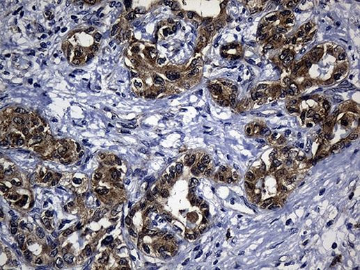 EARS2 Antibody in Immunohistochemistry (Paraffin) (IHC (P))