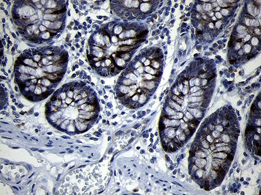 RRM2 Antibody in Immunohistochemistry (Paraffin) (IHC (P))