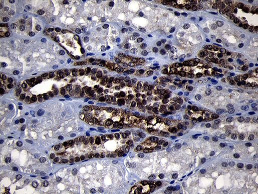 RRM2 Antibody in Immunohistochemistry (Paraffin) (IHC (P))