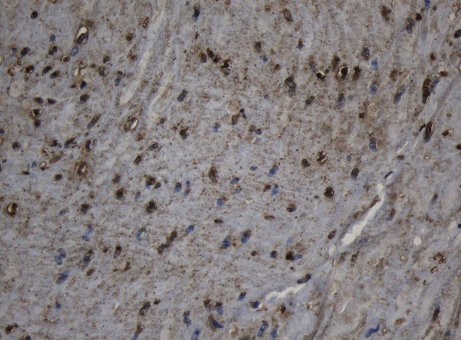 CPT1B Antibody in Immunohistochemistry (Paraffin) (IHC (P))