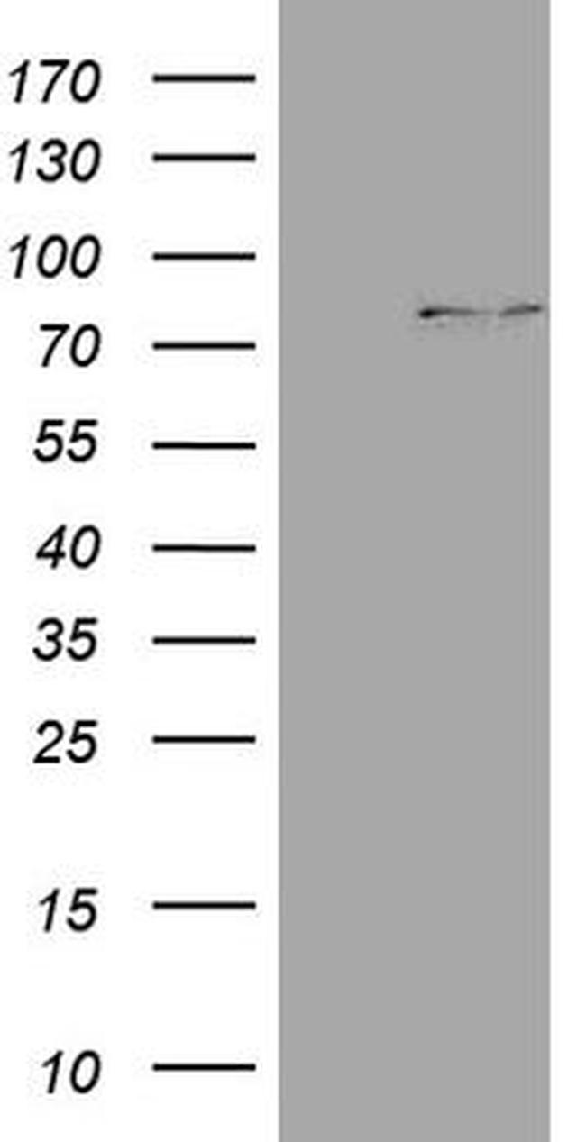 CPT1B Antibody in Western Blot (WB)