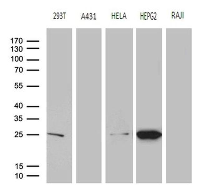 GSTZ1 Antibody in Western Blot (WB)