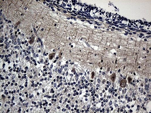 DNAJB6 Antibody in Immunohistochemistry (Paraffin) (IHC (P))