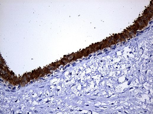 NAT1 Antibody in Immunohistochemistry (Paraffin) (IHC (P))