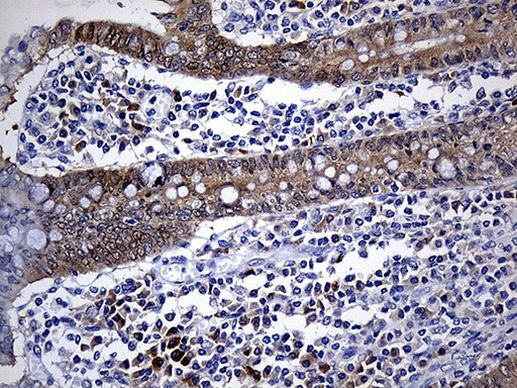 NAT1 Antibody in Immunohistochemistry (Paraffin) (IHC (P))