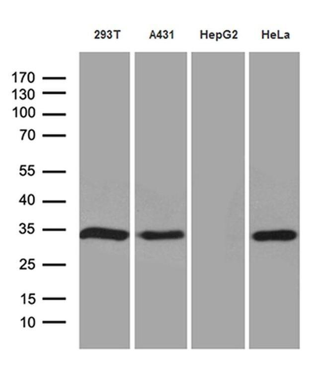 NAT1 Antibody in Western Blot (WB)