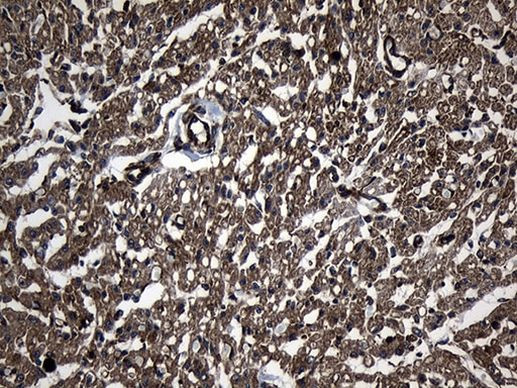 UBE2D4 Antibody in Immunohistochemistry (Paraffin) (IHC (P))