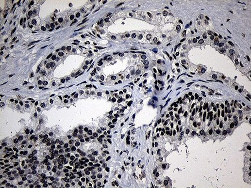 ELL Antibody in Immunohistochemistry (Paraffin) (IHC (P))