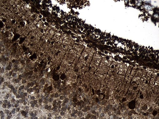 TCP-1 delta Antibody in Immunohistochemistry (Paraffin) (IHC (P))