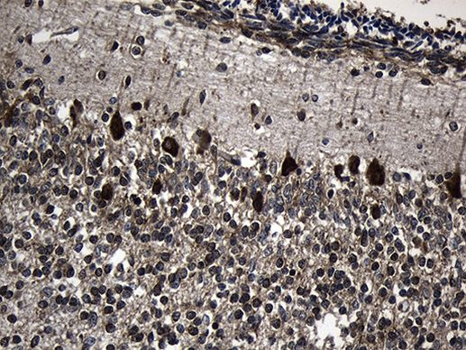 TCP-1 delta Antibody in Immunohistochemistry (Paraffin) (IHC (P))