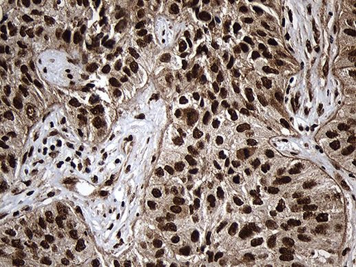 ASH2L Antibody in Immunohistochemistry (Paraffin) (IHC (P))