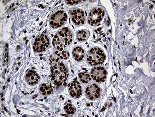 ASH2L Antibody in Immunohistochemistry (Paraffin) (IHC (P))