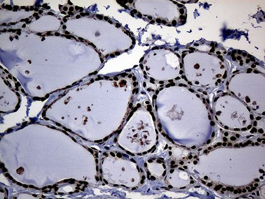 ASH2L Antibody in Immunohistochemistry (Paraffin) (IHC (P))