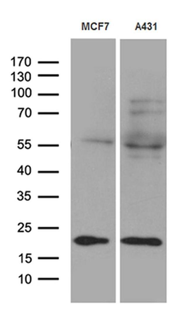 TIMM23 Antibody in Western Blot (WB)