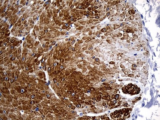 C1orf111 Antibody in Immunohistochemistry (Paraffin) (IHC (P))