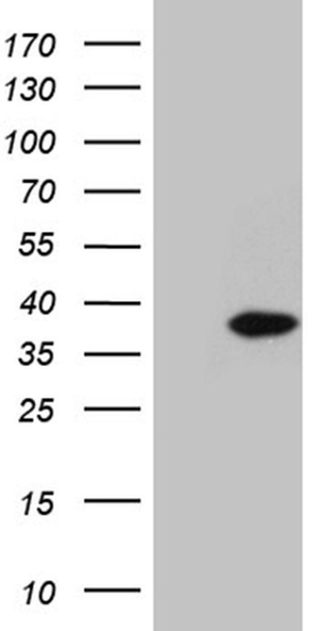 C1orf111 Antibody in Western Blot (WB)