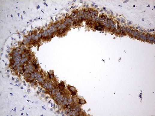 ABCF2 Antibody in Immunohistochemistry (Paraffin) (IHC (P))