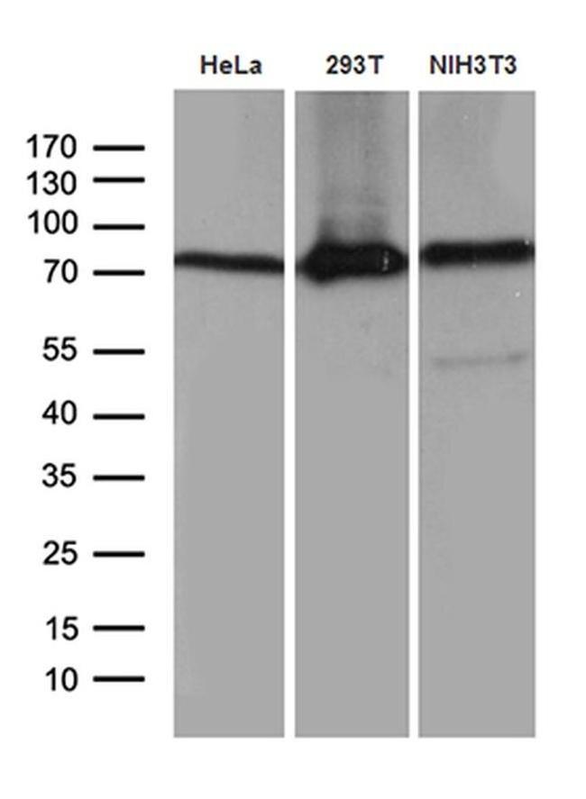 ABCF2 Antibody in Western Blot (WB)