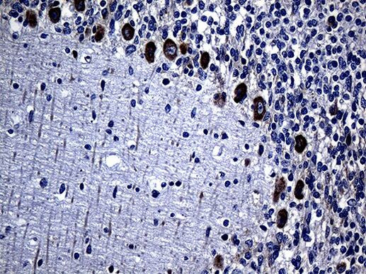 MMGT1 Antibody in Immunohistochemistry (Paraffin) (IHC (P))