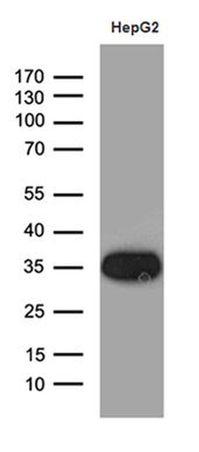 SULT1A3 Antibody in Western Blot (WB)