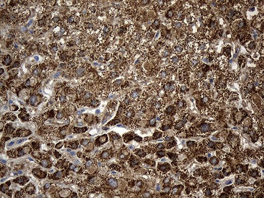 ALDH7A1 Antibody in Immunohistochemistry (Paraffin) (IHC (P))