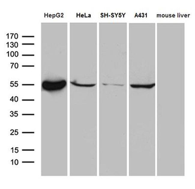 ALDH7A1 Antibody in Western Blot (WB)