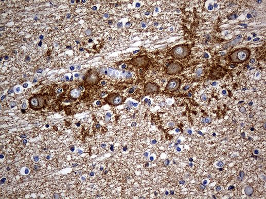 Septin 3 Antibody in Immunohistochemistry (Paraffin) (IHC (P))