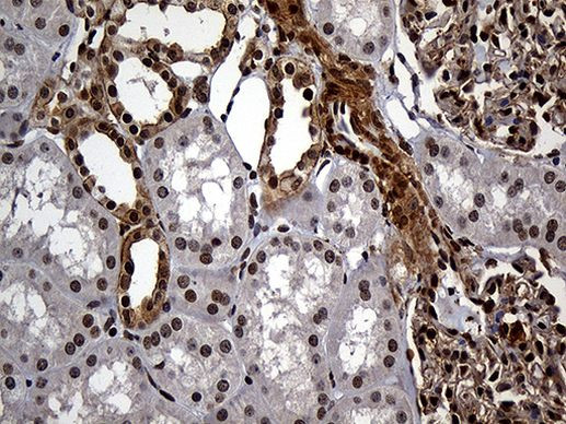 RAD21 Antibody in Immunohistochemistry (Paraffin) (IHC (P))