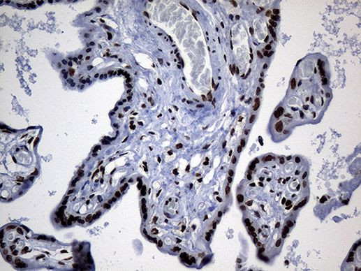 PPAR delta Antibody in Immunohistochemistry (Paraffin) (IHC (P))