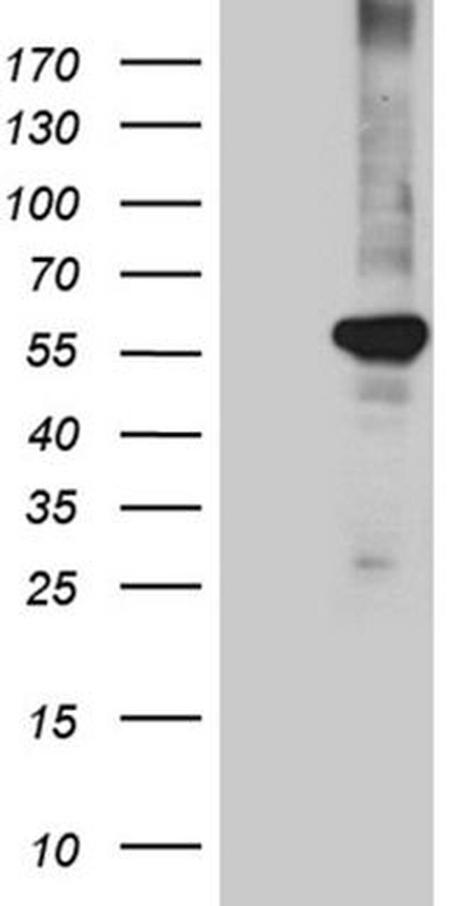 PPAR delta Antibody in Western Blot (WB)