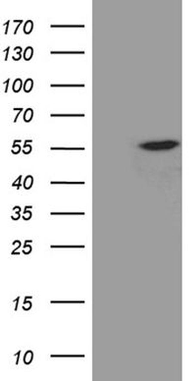 EXOC4 Antibody in Western Blot (WB)