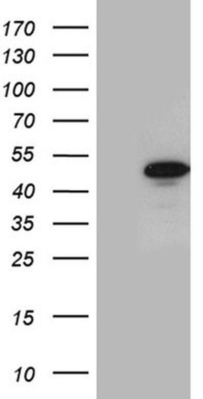 GABPB1 Antibody in Western Blot (WB)