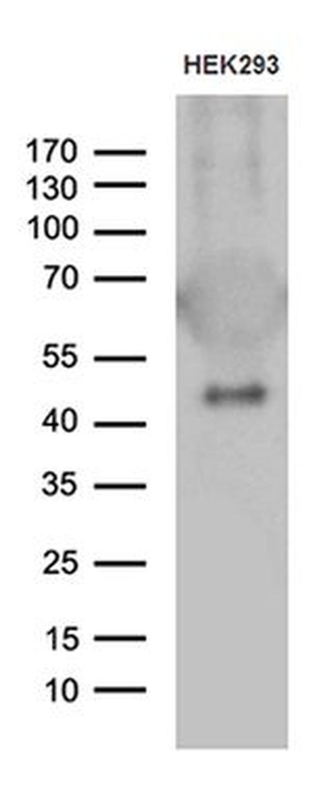 GABPB1 Antibody in Western Blot (WB)