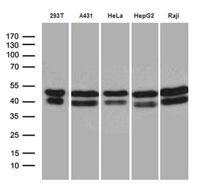 GABPB1 Antibody in Western Blot (WB)