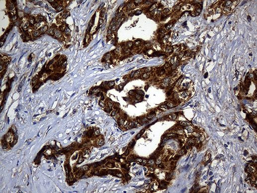 ALDH7A1 Antibody in Immunohistochemistry (Paraffin) (IHC (P))