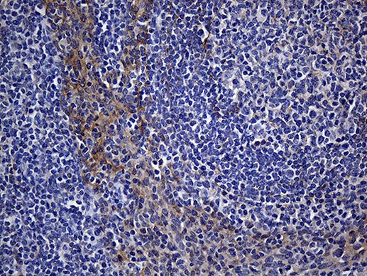 N-WASP Antibody in Immunohistochemistry (Paraffin) (IHC (P))