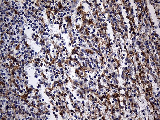 N-WASP Antibody in Immunohistochemistry (Paraffin) (IHC (P))