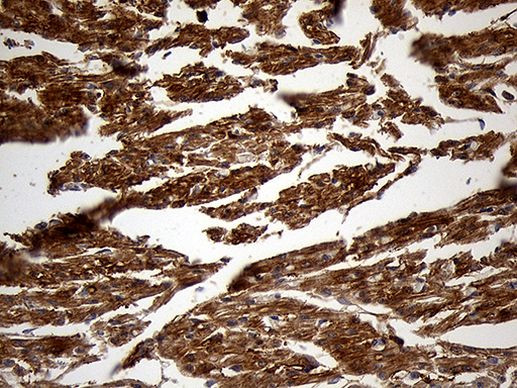 PYGM Antibody in Immunohistochemistry (Paraffin) (IHC (P))