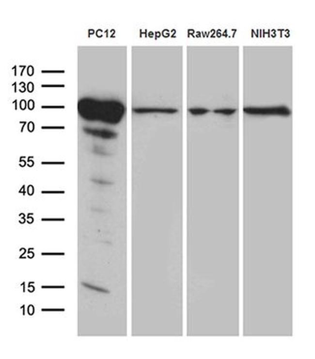 PYGM Antibody in Western Blot (WB)