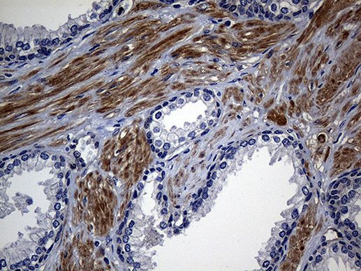 SULT1A3 Antibody in Immunohistochemistry (Paraffin) (IHC (P))