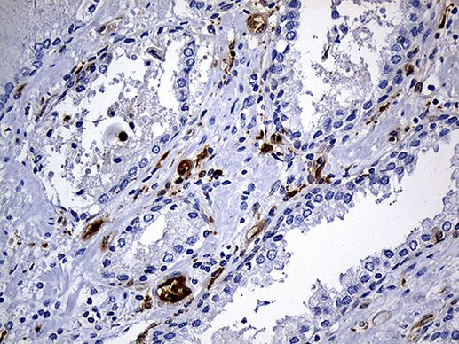 SULT1A3 Antibody in Immunohistochemistry (Paraffin) (IHC (P))