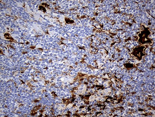 SULT1A3 Antibody in Immunohistochemistry (Paraffin) (IHC (P))